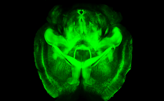 A fluorescent mouse brain, imaged using the CLARITY technique.
