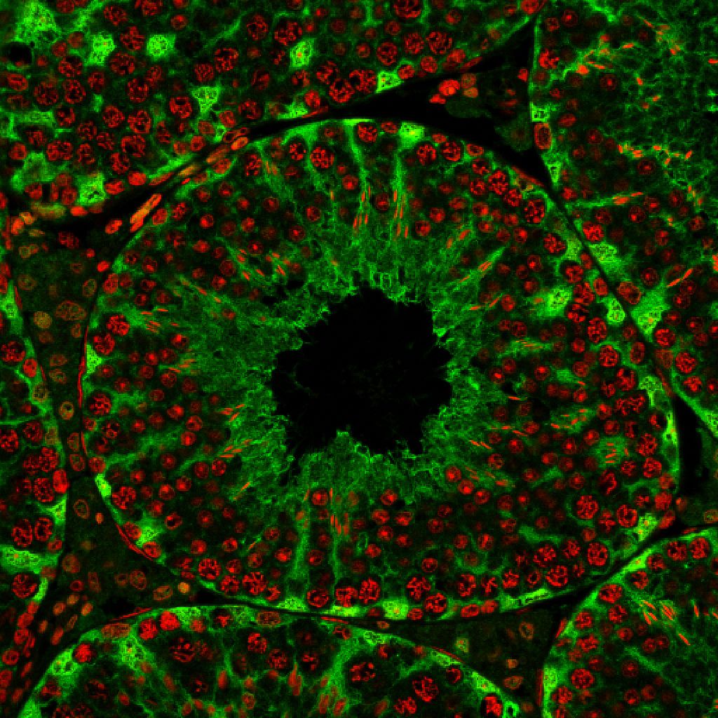 This is an image of a cross-section through a seminiferous tubule, where sperm is made. The cells in green are the supporting cells (containing Katnal1), the red cells are developing sperm.