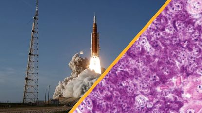 Two images with a diagonal golden line between them. The left shows the Artemis II rocket blasting off from the launch pad and the right shows a close up of a purple and pink pancreas tissue sample
