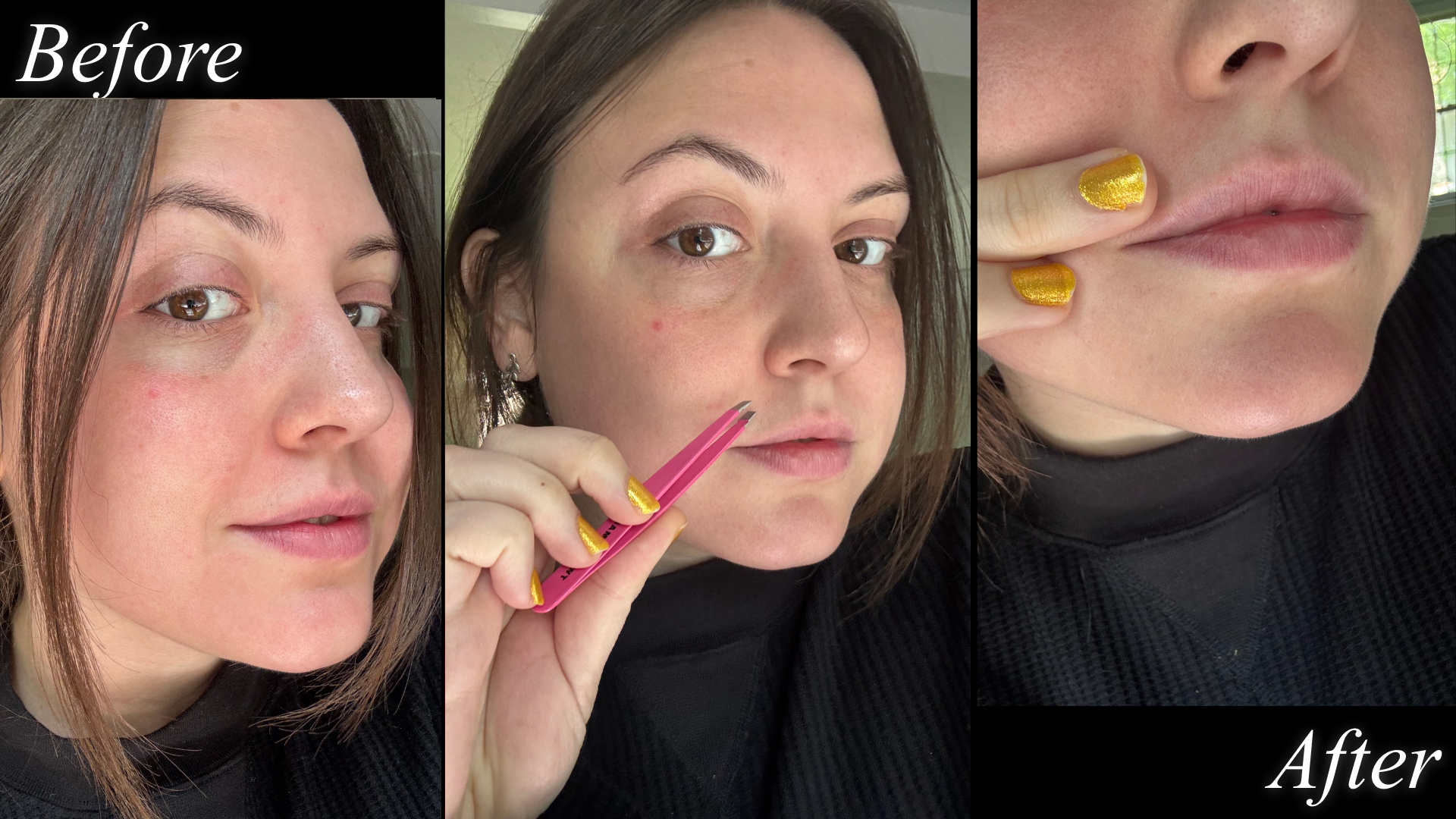 Three close-ups of freelance beauty writer Sophia Vilensky's face before, during, and after she plucks some rogue upper lip hairs.