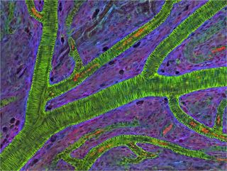 Blood vessels in a mouse retina