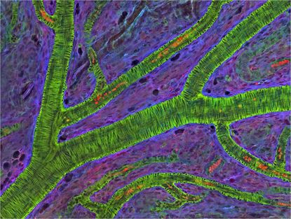 Blood vessels in a mouse retina