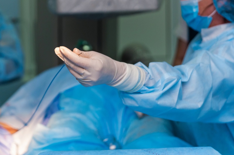 Doctor performing an angioplasty.
