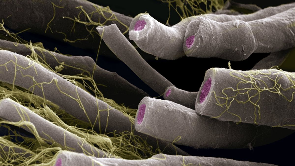 An electron microscope image showing myelin insulating nerve fibers