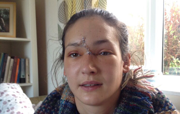 lizpostsurgery
