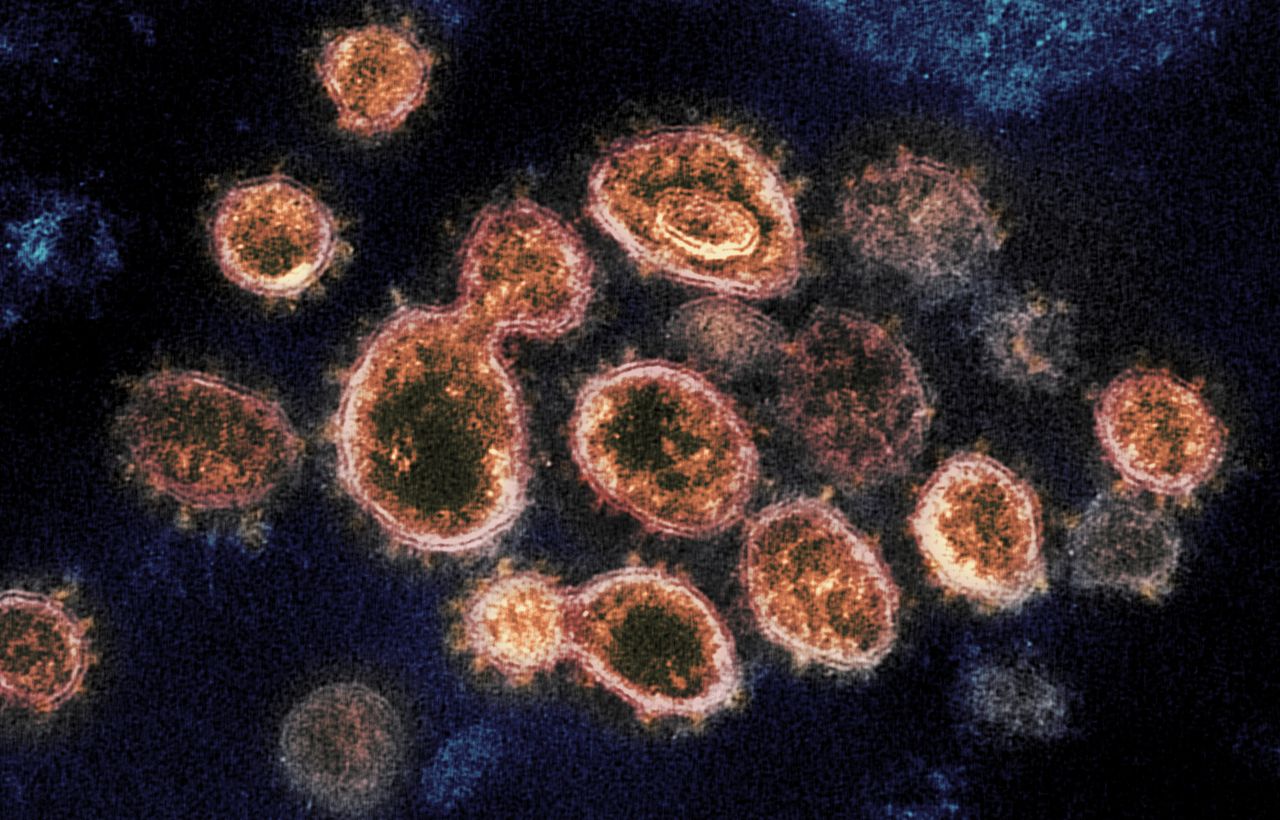 Coronavirus particles.