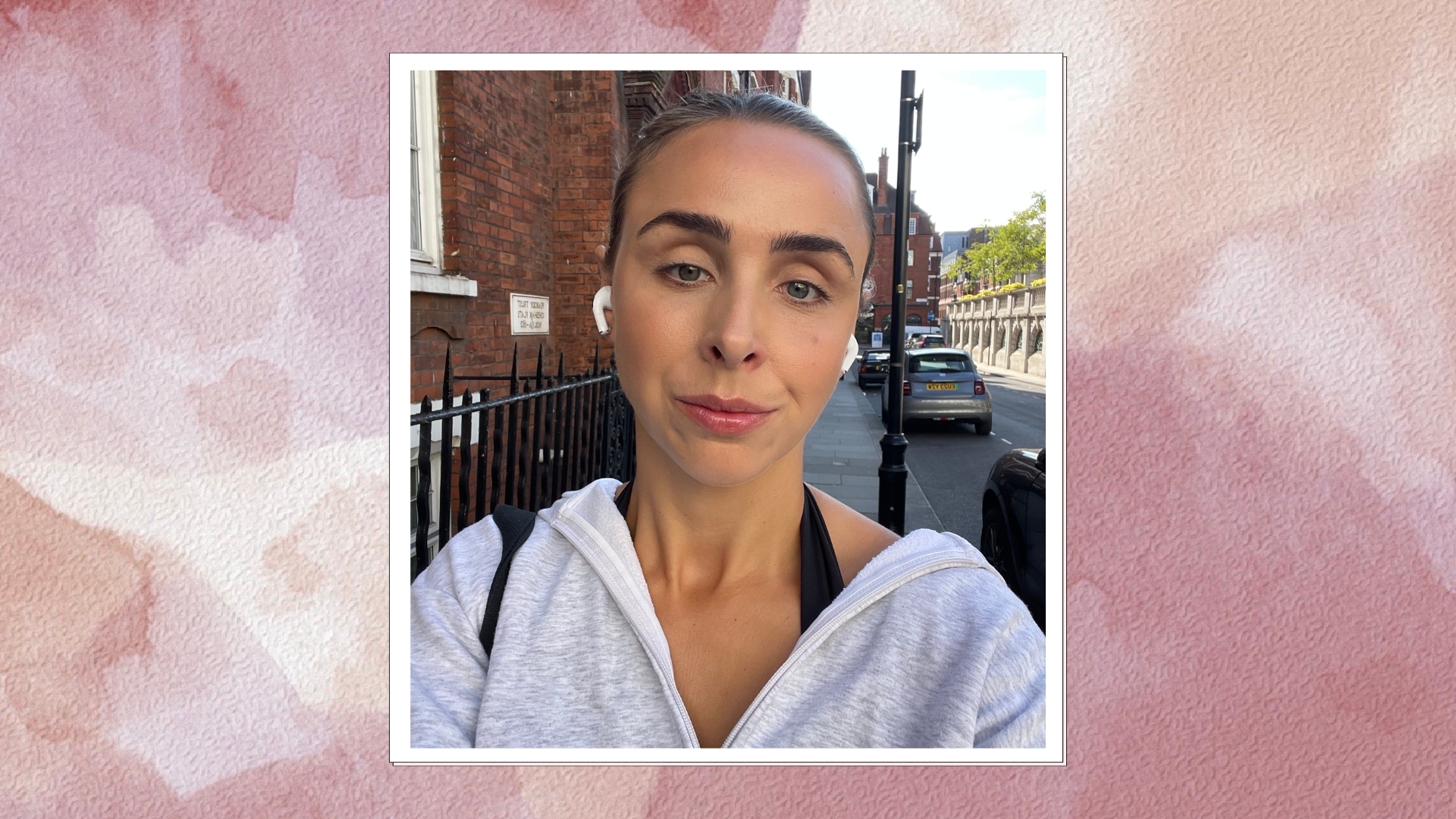Beauty contributor Emma Stoddart after HIFU treatment