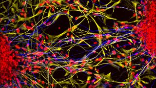 Neurons (yellow) spread out among other cells called astrocytes (blue).