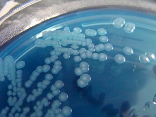 Aeromonas bacteria in a dish