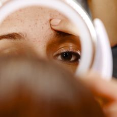 close up of woman looking at forehead acne in mirror