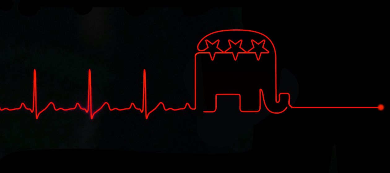 A heart monitor.