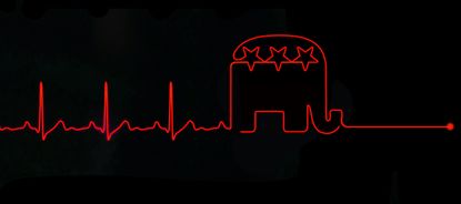 A heart monitor.