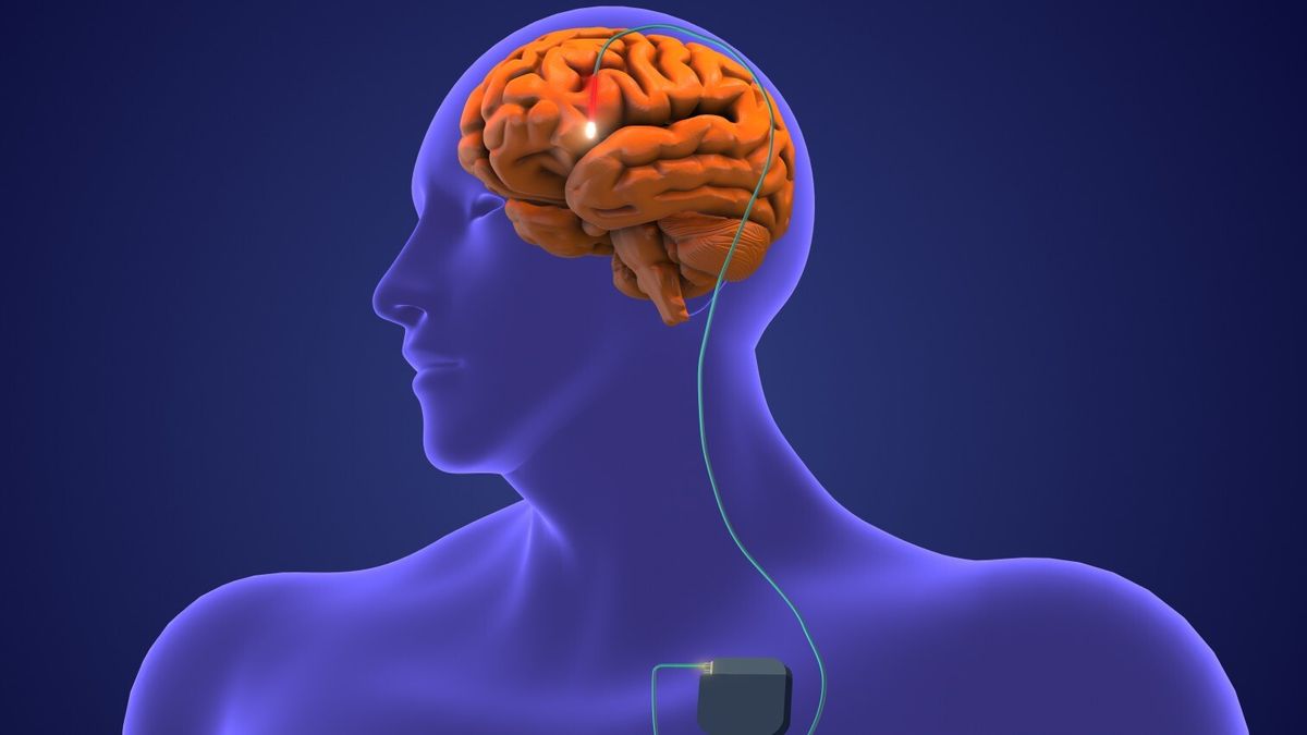 Electrical stimulation could treat traumatic brain injuries | Live