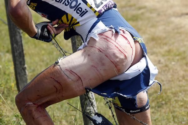 Johnny Hoogerland's ripped up flesh drew gasps of shock around the world