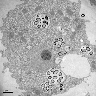 Electron microscopy image of an amoeba (Acanthamoeba) filled with Pandoravirus particles.