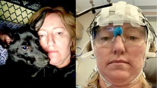 2 selfies of middle-age white woman with reddish hair. In one, she's pictured resting with her dog. In the second, she's in a clinic wearing googles with a transcranial stimulation device on her head 
