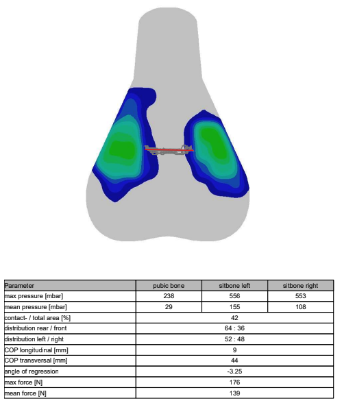 A visual output of saddle pressure mapping
