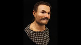 Slonk Hill man facial reconstruction