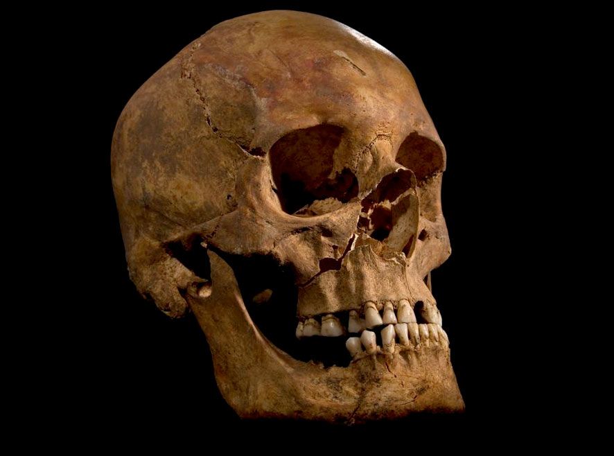 skull of what may be King Richard III