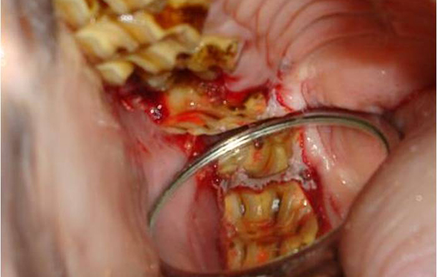 Mini teeth 2_197792432_273733261
