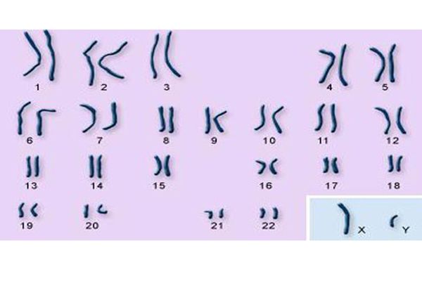 Chromosomes Definition And Structure Live Science