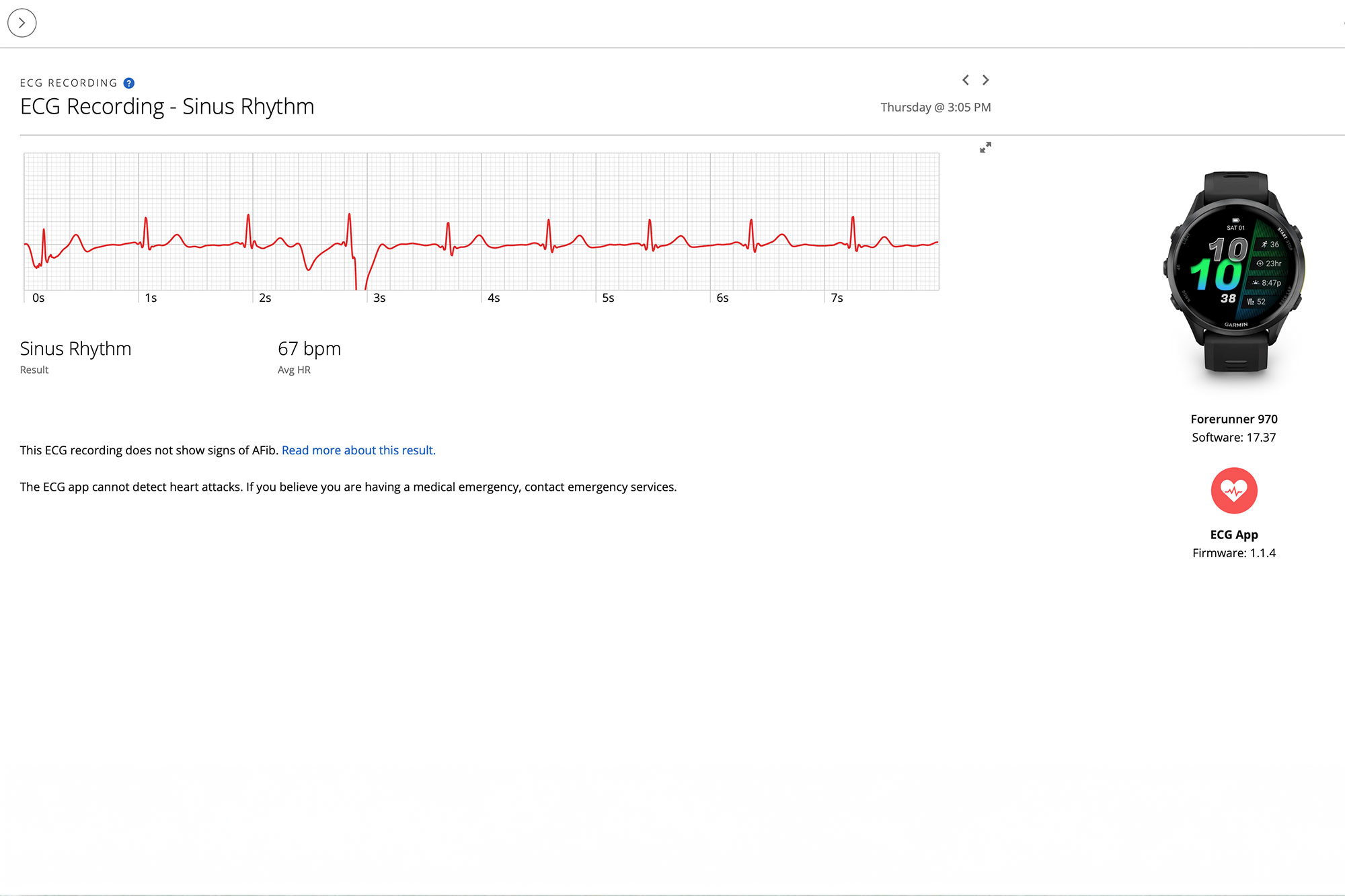 Garmin Connect screen showing ECG trace