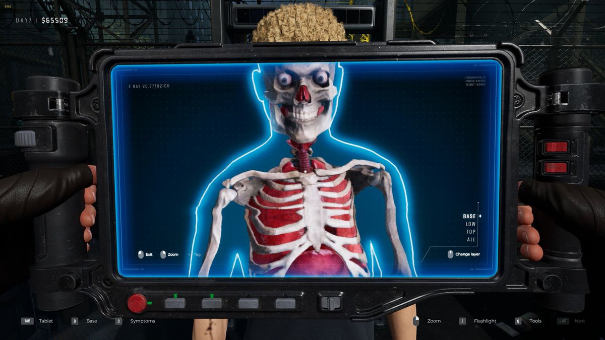 Quarantine Zone has been patched so now you can actually detect people smuggling hand grenades in their butts