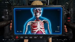 An X-Ray scanning someone's insides