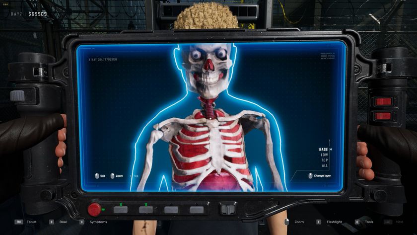 An X-Ray scanning someone's insides