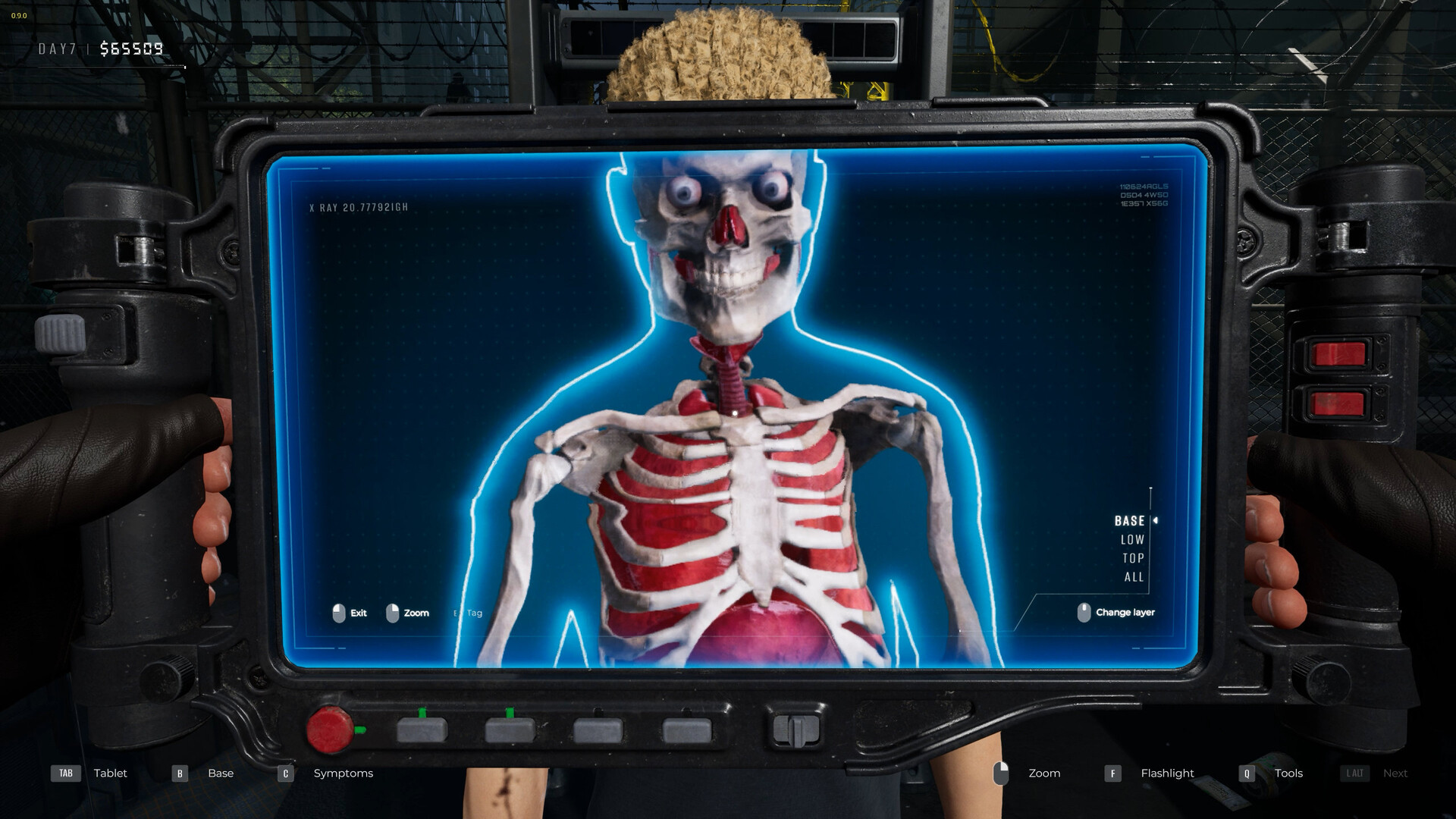 An X-Ray scanning someone's insides