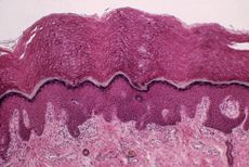 Scientists discovered the new organ, which consists of fluid-filled spaces, in the body's connective tissue, including in the skin's dermis, which is shown above as the light pink layer at the bottom of this image.