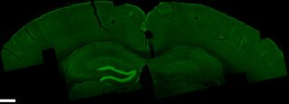 In experiments, researchers stimulated an area in the mouse brain called the hippocampus, shown in bright green through fluorescent labeling.
