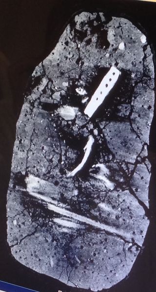The earth deposit containing the Viking tools was examined with computerized tomography (CT) scanning equipment at a local hospital before the individual tools were excavated from the deposit.