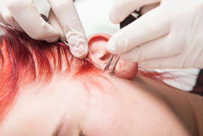 Piercing professional pushing the cannula through the skin while he is gripping the ear, what is a daith piercing