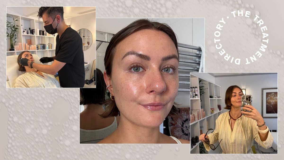 Polynucleotides Are the Buzzy Skin Treatment Celebs Can't Get Enough of—Here's My Hot Take