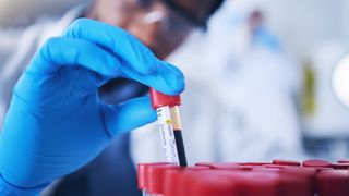 Close-up of a scientist picking up a test tube with a red lid containing blood. The scientists' hand is in focus and they are wearing blue gloves. The test tube is picked up from amongst what looks like a group of tubes, where the red tops are only visible. The scientists blurred face is shown in the background. They are wearing goggles. 