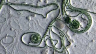 photo shows long green threads of cyanobacteria that resemble yarn