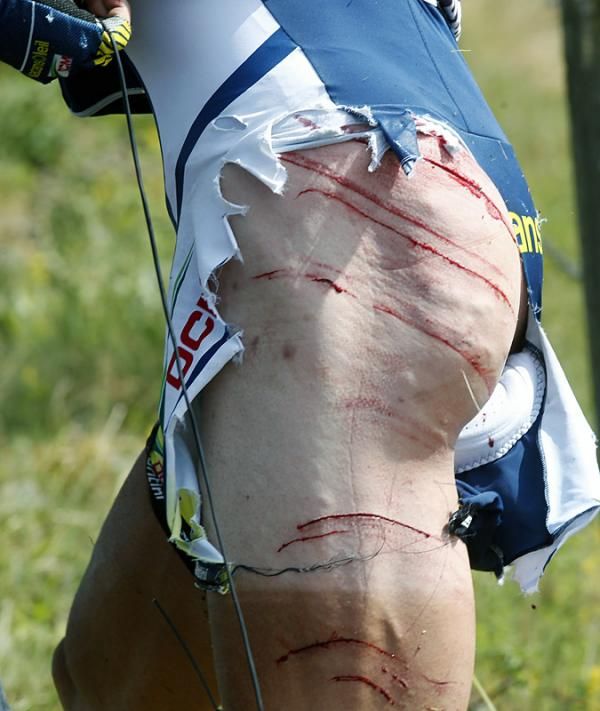 Johnny Hoogerland (Vacansoleil-DCM) crashed onto a barbed wire fence after he and breakaway companion Juan Antonio Flecha were hit by a car from French television.