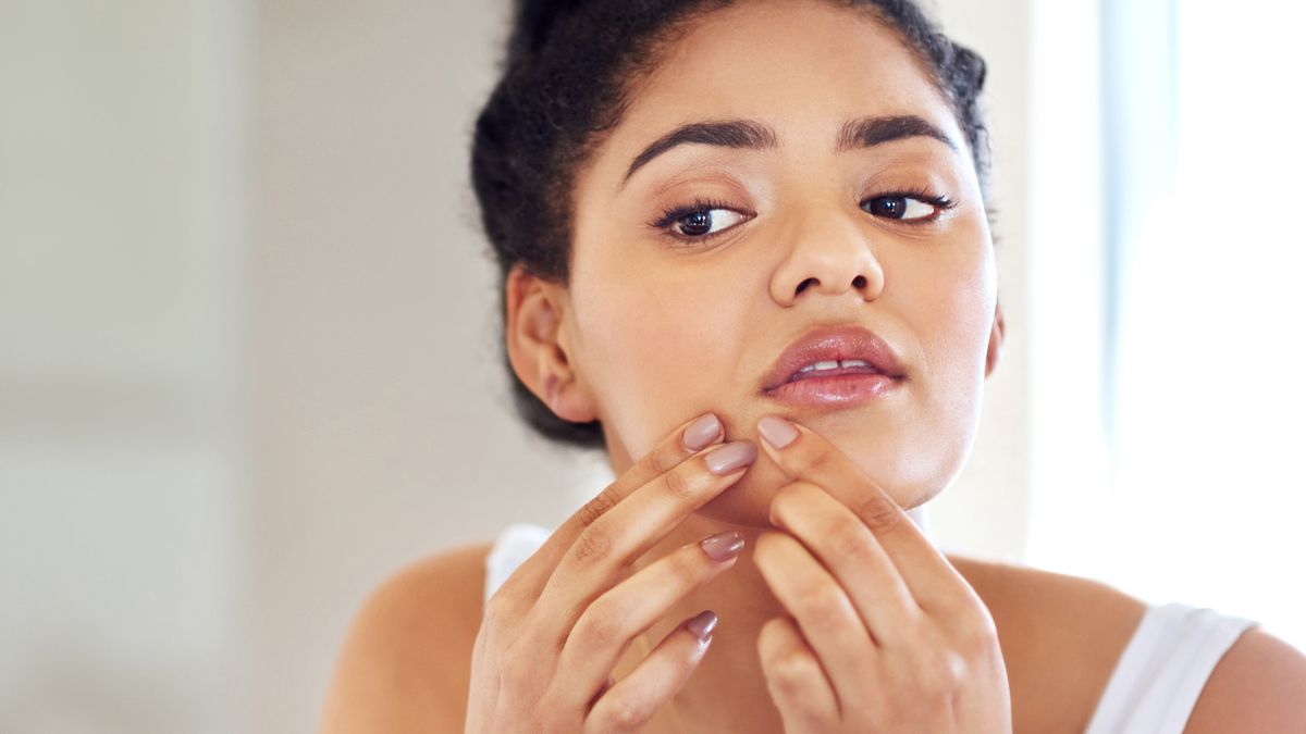 Exactly How to Tell If Your Skin Is Purging or Breaking Out