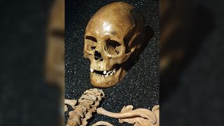 photo of the skull, upper vertebrae and collar bones of G