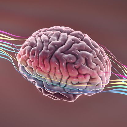 brain with wires