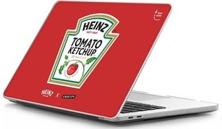 Heinz Keystone Case Macbook Casetify