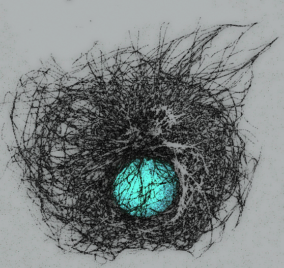 nikon small world competition, microtubules, nucleus, COS-7