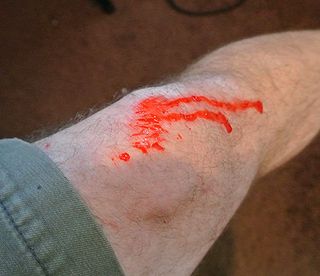 No, it's not a cut. I just spilled a little red coolant on my pasty, white leg.