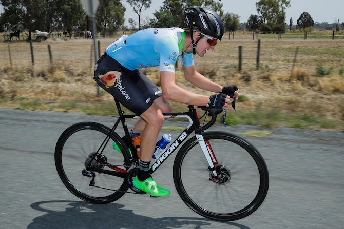 Team BridgeLane sprinter Nick White shows the effects of his crash early on stage 1