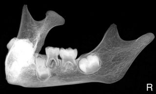 mandible of toddler from egypt cemetery