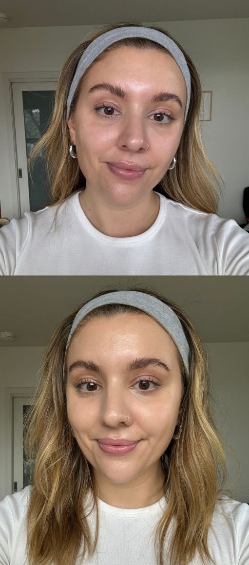 L'Oreal before and after