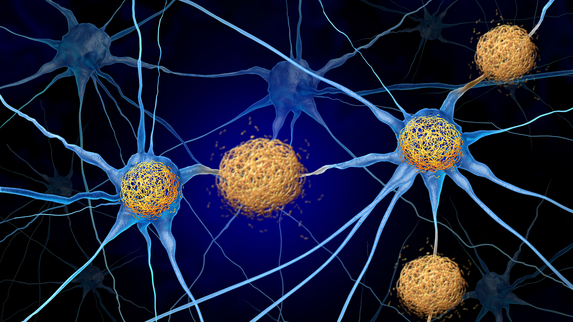 An illustration of various gold spheres connected by blue filaments against a blue background