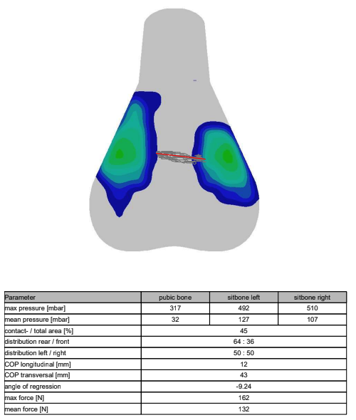 A visual output of saddle pressure mapping