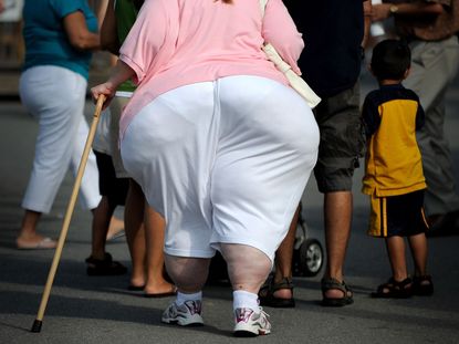 An obese woman